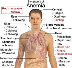 শরীরে রক্ত কম হলে কি কি সমস্যা হয় 2 animia