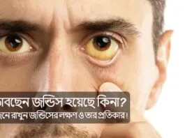 jaundice-symptoms-and-remedies