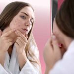 Effective ways to reduce acne from the inside