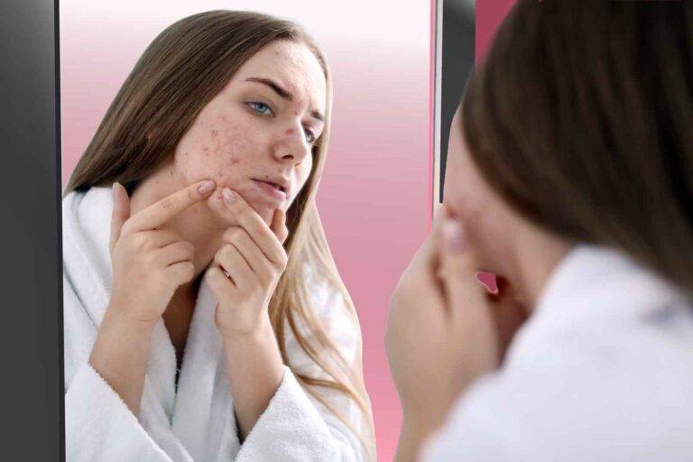 Effective ways to reduce acne from the inside