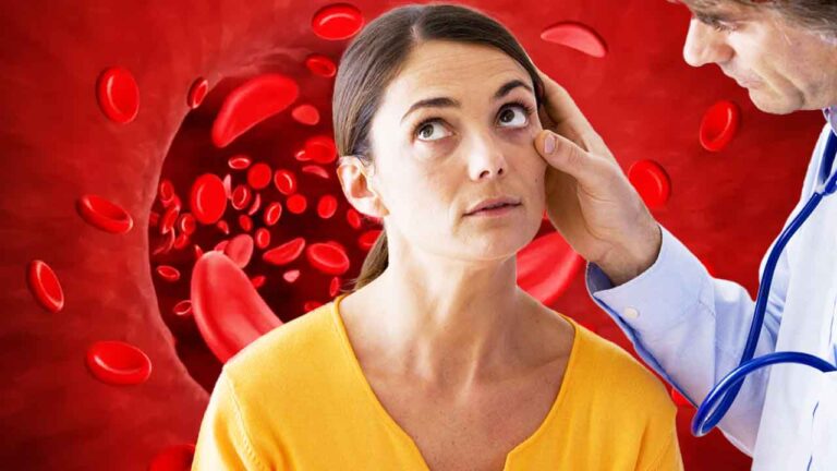 symptoms-and-remedy-of-anemia